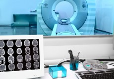 歯科インプラント、CTやMRIでの影響は?