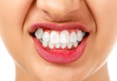 インプラントが外れる「歯ぎしり」の原因と対処法